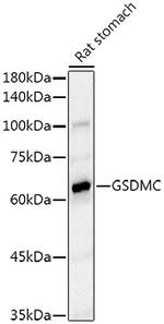 GSDMC Antibody in Western Blot (WB)