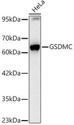 GSDMC Antibody in Western Blot (WB)