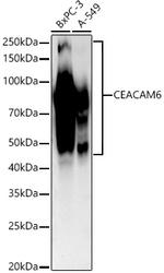 CEACAM6 Recombinant Rabbit Monoclonal Antibody (5X3E4)