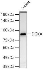 DGKA Antibody in Western Blot (WB)
