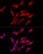 AKR1B1 Recombinant Rabbit Monoclonal Antibody (8W5L1)