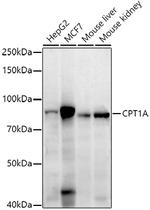 CPT1A Recombinant Rabbit Monoclonal Antibody (8Y1J4)