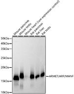 ARMET Recombinant Rabbit Monoclonal Antibody (8I8D5)