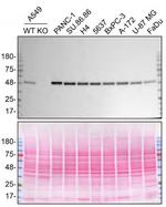 TRIM21 Recombinant Rabbit Monoclonal Antibody (7Q6C3)