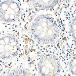 TNF alpha Antibody in Immunohistochemistry (Paraffin) (IHC (P))