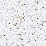 TNF alpha Antibody in Immunohistochemistry (Paraffin) (IHC (P))