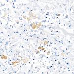 TNF alpha Antibody in Immunohistochemistry (Paraffin) (IHC (P))