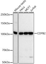 COPB2 Antibody in Western Blot (WB)