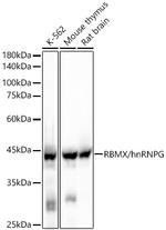 RBMX Recombinant Rabbit Monoclonal Antibody (7N9Z5)