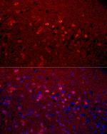 Calretinin Antibody in Immunocytochemistry (ICC/IF)
