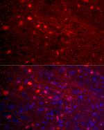 Calretinin Antibody in Immunocytochemistry (ICC/IF)