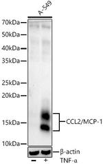 MCP-1 Recombinant Rabbit Monoclonal Antibody (7Y7F4)