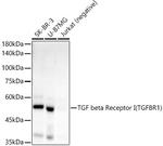 TGFBR1 Recombinant Rabbit Monoclonal Antibody (1Y8U8)