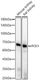 PCK1 Recombinant Rabbit Monoclonal Antibody (4N1E6)