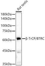 BTRC Recombinant Rabbit Monoclonal Antibody (2Z4D4)