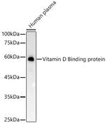 GC Recombinant Rabbit Monoclonal Antibody (4P7B3)