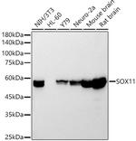 SOX11 Recombinant Rabbit Monoclonal Antibody (5K1J5)
