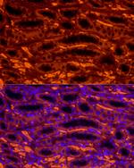 IGF2BP1 Recombinant Rabbit Monoclonal Antibody (3C1L7)