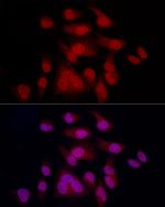 MiTF Recombinant Rabbit Monoclonal Antibody (6S9G4)