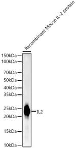 IL-2 Recombinant Rabbit Monoclonal Antibody (2L3B5)