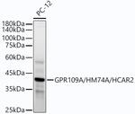 HCAR2 Recombinant Rabbit Monoclonal Antibody (7A3F2)