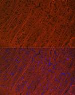MAP2 Recombinant Rabbit Monoclonal Antibody (2W0O8)