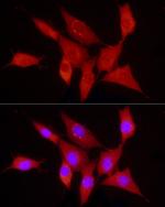 PDGF-B Antibody in Immunocytochemistry (ICC/IF)
