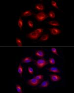 Melan-A Recombinant Rabbit Monoclonal Antibody (8U1D0)