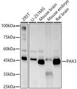 PAX3 Recombinant Rabbit Monoclonal Antibody (9A6M6)