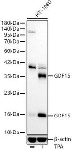 GDF15 Antibody in Western Blot (WB)
