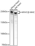 MYH7 Recombinant Rabbit Monoclonal Antibody (5Q7V6)