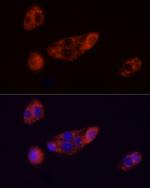 ADFP Recombinant Rabbit Monoclonal Antibody (9W7Y9)