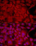 PHGDH Antibody in Immunocytochemistry (ICC/IF)
