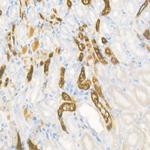 PHGDH Antibody in Immunohistochemistry (Paraffin) (IHC (P))