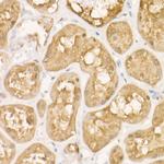 PHGDH Antibody in Immunohistochemistry (Paraffin) (IHC (P))