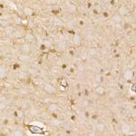 PHGDH Antibody in Immunohistochemistry (Paraffin) (IHC (P))