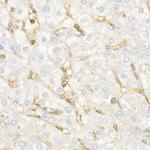 IFITM1 Antibody in Immunohistochemistry (Paraffin) (IHC (P))