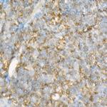IFITM1 Antibody in Immunohistochemistry (Paraffin) (IHC (P))