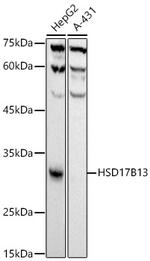 HSD17B13 Recombinant Rabbit Monoclonal Antibody (10T10L5)