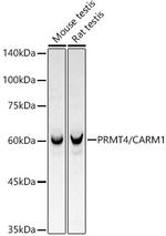 PRMT4 Recombinant Rabbit Monoclonal Antibody (4Y3I1)