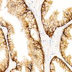 MRP4 Recombinant Rabbit Monoclonal Antibody (3K4F4)