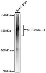 MRP4 Antibody in Western Blot (WB)