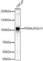 PSMA Antibody in Western Blot (WB)