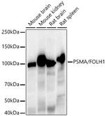 PSMA Recombinant Rabbit Monoclonal Antibody (7M9F5)