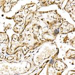CHOP Antibody in Immunohistochemistry (Paraffin) (IHC (P))
