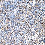 Interferon alpha-2 Antibody in Immunohistochemistry (Paraffin) (IHC (P))