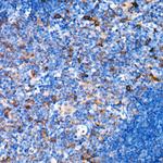 Interferon alpha-2 Antibody in Immunohistochemistry (Paraffin) (IHC (P))