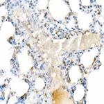 Interferon alpha-2 Antibody in Immunohistochemistry (Paraffin) (IHC (P))