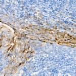 S100A7 Recombinant Rabbit Monoclonal Antibody (7G4P7)