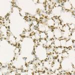 WEE1 Recombinant Rabbit Monoclonal Antibody (6V1Y6)